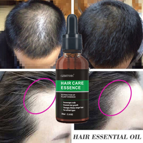 Hair Growth Oil Hair Growth Oil Oem Hair Care Essential Oil - Image 6